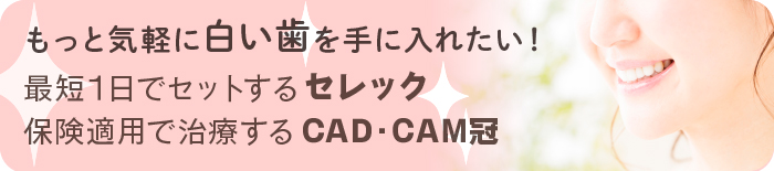 セレック・保険適用で治療するCAD/CAM冠
